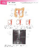 Sobotta  Atlas of Human Anatomy  Trunk, Viscera,Lower Limb Volume2 2006, page 181